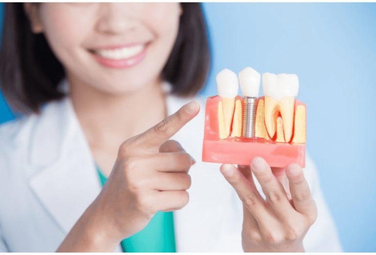 5 Excellent Reasons to Invest in Dental Health Care