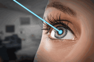 guide for laser eye surgery