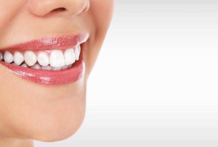 7 Benefits of Getting a Modern Cosmetic Dentistry Procedure
