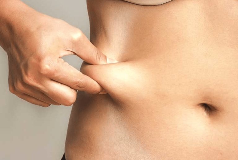 Fat-Freezing Procedures: Things You Need To Know