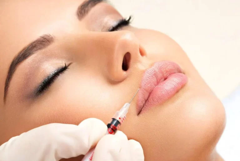Lip Injection & Lips Fillers After Care Tips & Tricks