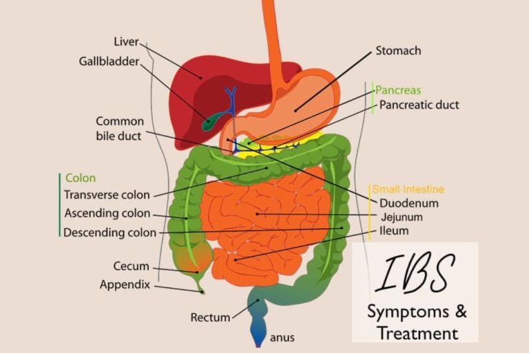 How to Better Manage Your IBS Symptoms and Flare-Ups