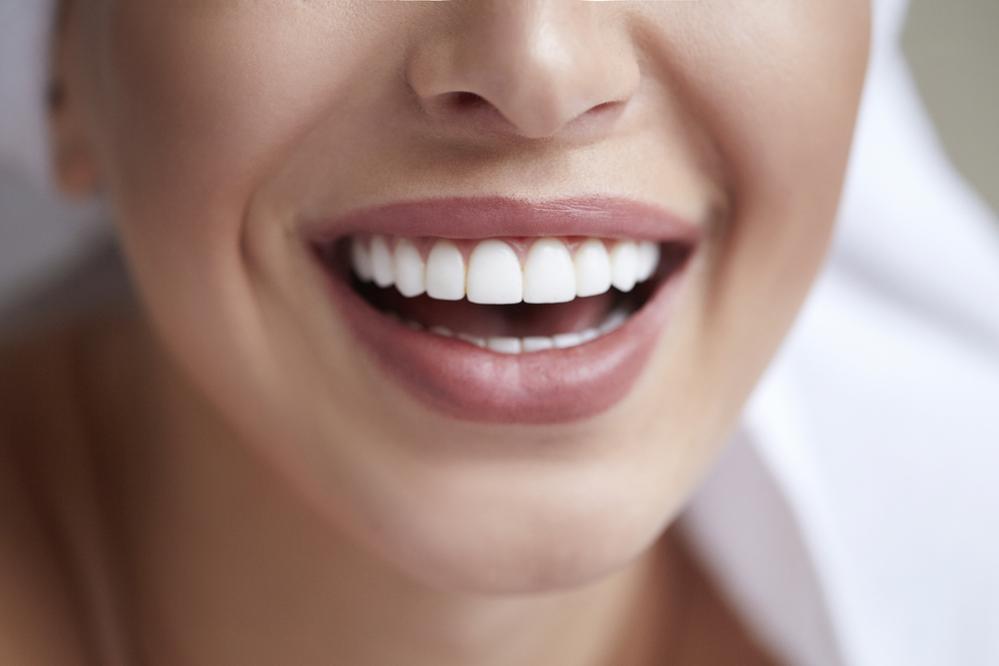 Why Veneers Are the Ultimate Beauty Secret