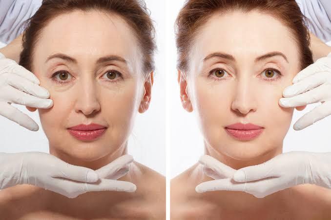 How to Prepare for Facelift Surgery